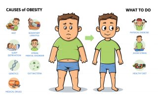 Obesity causes and prevention