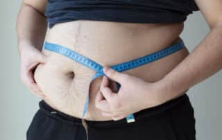 medical weight loss los angeles ca